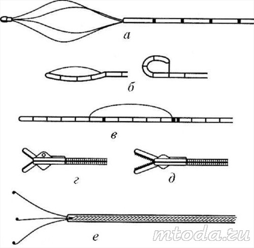 Инструменты для уретеролитоэкстракции: а - плетенка Дормиа; б - петля Цейса; в - петля Девиса; г - биопсийные щипцы; д - щипцы «аллигатор»; е - зажим «птичья лапа»